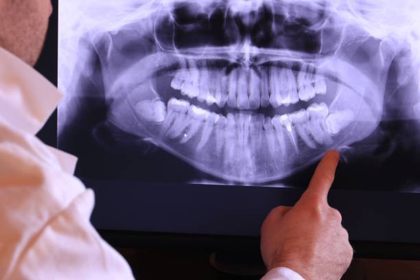 Best Emergency Dental Care for Broken or Chipped Teeth in Rollingwood, TX