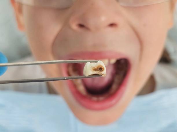 Best Emergency Gum Treatment in Rollingwood, TX